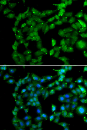 Anti-PRKAB2 Antibody (CAB13341)