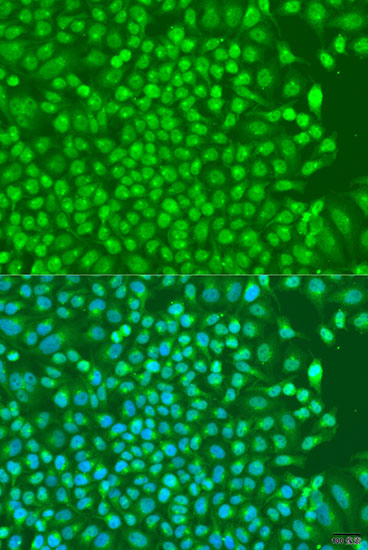 Anti-NKX2-5 Antibody (CAB5651)