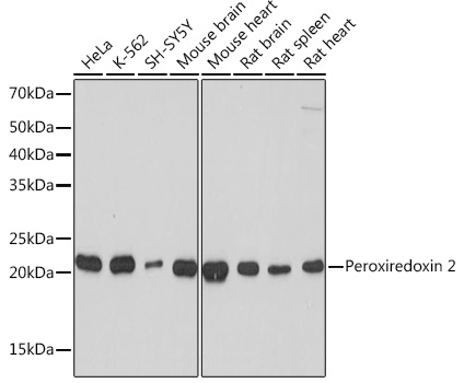 Anti-Peroxiredoxin 2 Antibody (CAB4308)