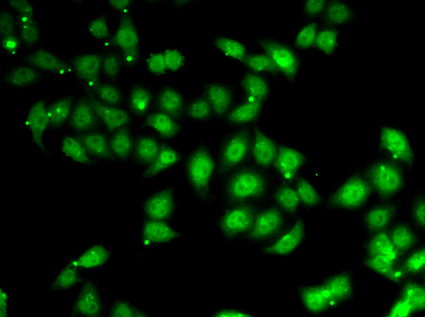 Anti-AFF1 Antibody (CAB6933)