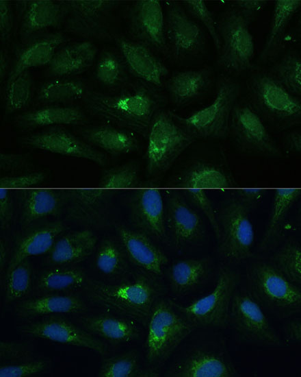 Anti-AEBP1 Antibody (CAB16340)