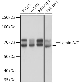 Anti-Lamin A/C Antibody [KO Validated] (CAB19524)