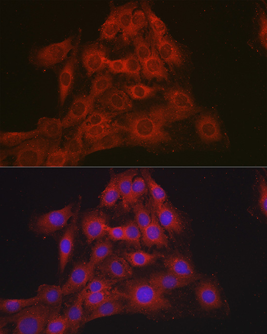 Anti-NR3C2 Antibody (CAB3308)