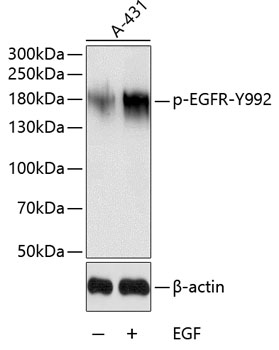 Anti-Phospho-EGFR-Y992 Antibody (CABP0026)