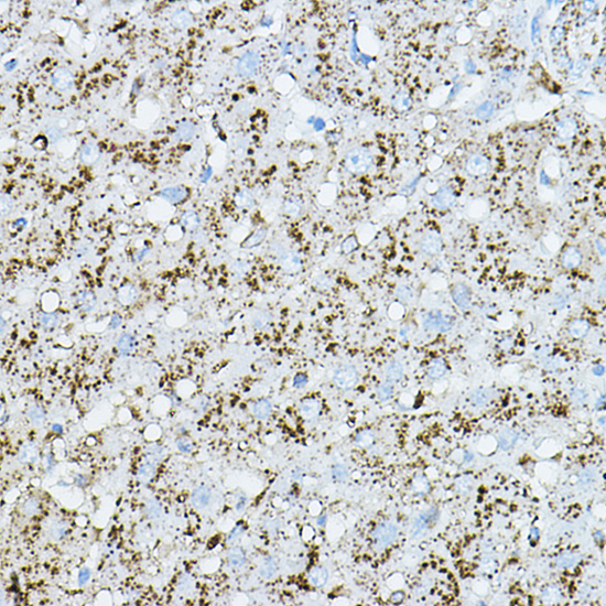 Anti-CTSD Antibody (CAB13292)