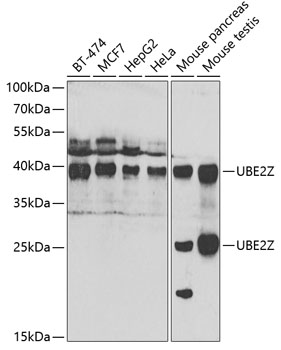 Anti-UBE2Z Antibody (CAB7225)