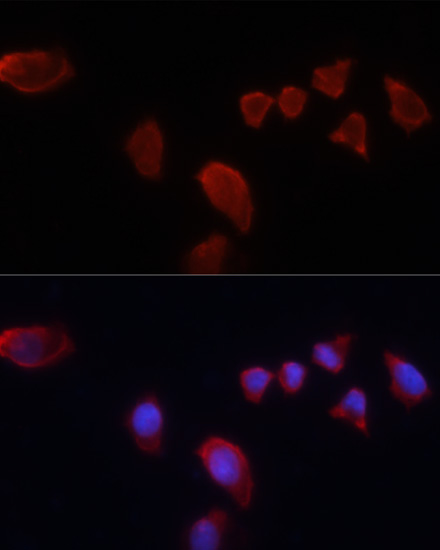 Anti-CA9 Antibody (CAB13682)