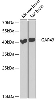 Anti-GAP43 Antibody (CAB6376)