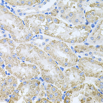 Anti-TARS Antibody (CAB6993)