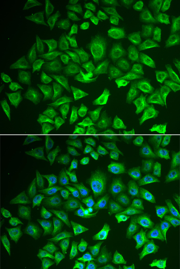 Anti-EHHADH Antibody (CAB13488)