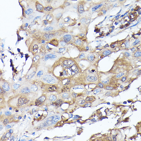 Anti-MLST8 Antibody (CAB13599)