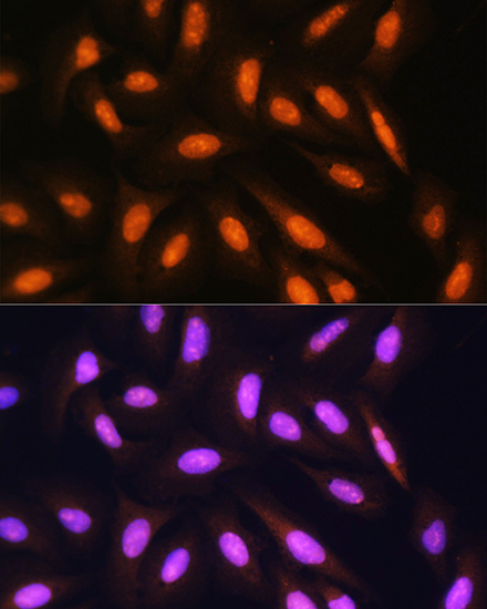 Anti-PPP1CB Antibody (CAB13528)