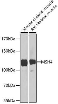 Anti-MSH4 Polyclonal Antibody (CAB8556)