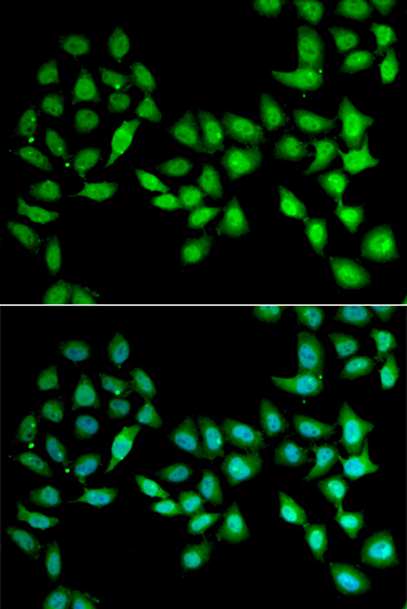 Anti-UCN2 Antibody (CAB6485)