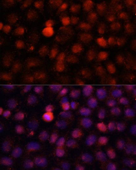 Anti-N4-Methylcytidine Antibody (CAB15989)