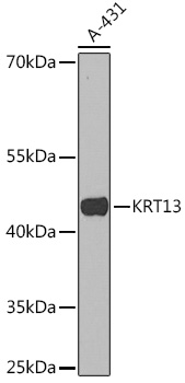 Anti-KRT13 Antibody (CAB16393)