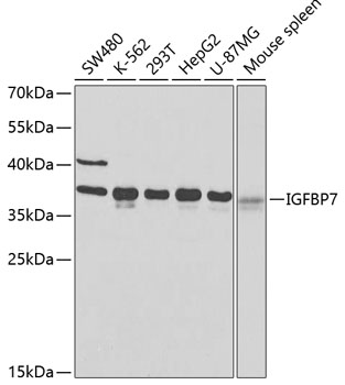 Anti-IGFBP7 Antibody (CAB2982)