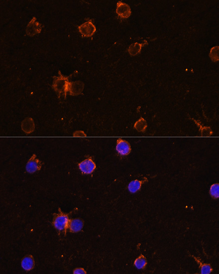 Anti-CD11B Antibody (CAB1581)