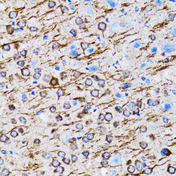 Anti-MAP1LC3A Antibody (CAB11438)