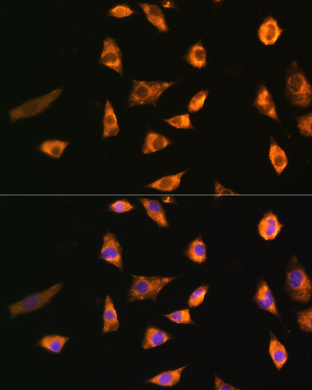 Anti-SPRR3 Antibody (CAB12041)