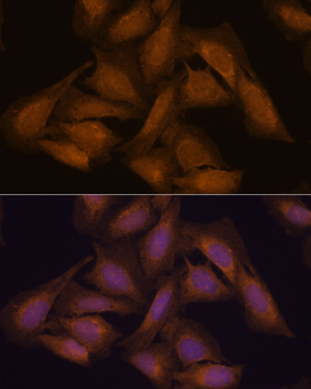 Anti-SEPT3 Antibody (CAB16551)