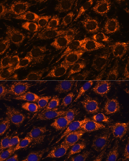 Anti-ACAA2 Antibody (CAB15778)