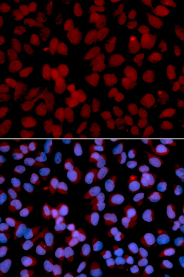 Anti-TNFAIP3 Antibody (CAB13637)