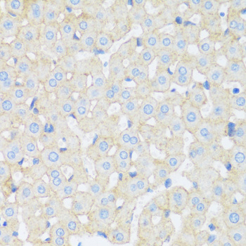 Anti-ASGR1 Antibody (CAB16766)