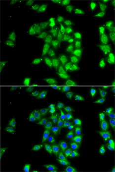 Anti-ANTXR1 Antibody (CAB6525)