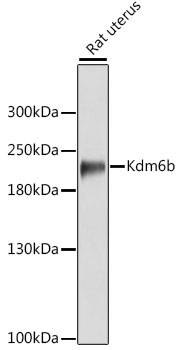 Anti-Kdm6b Antibody (CAB12764)
