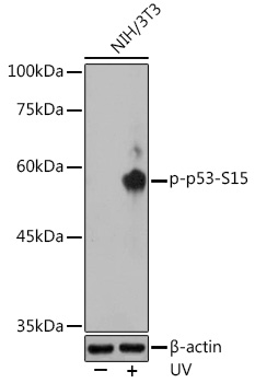 Anti-Phospho-p53-S15 Antibody (CABP0083)