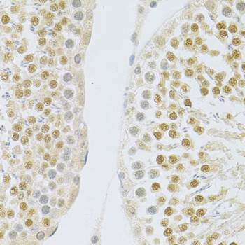 Anti-SLC39A7 Antibody (CAB3343)