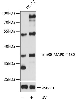 Anti-Phospho-MAPK14-T180 Antibody (CABP0056)