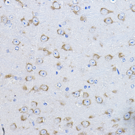 Anti-FAK Antibody (CAB11531)