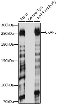 Anti-CKAP5 Polyclonal Antibody (CAB8532)