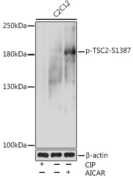 Anti-Phospho-TSC2-S1387 Antibody (CABP1117)