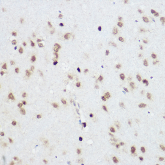 Anti-PLZF Antibody (CAB5863)