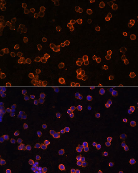 Anti-ENTPD1/CD39 Antibody (CAB3778)