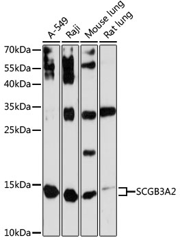 Anti-SCGB3A2 Antibody (CAB13137)