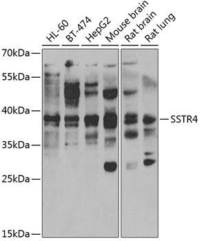 Anti-SSTR4 Antibody (CAB6988)