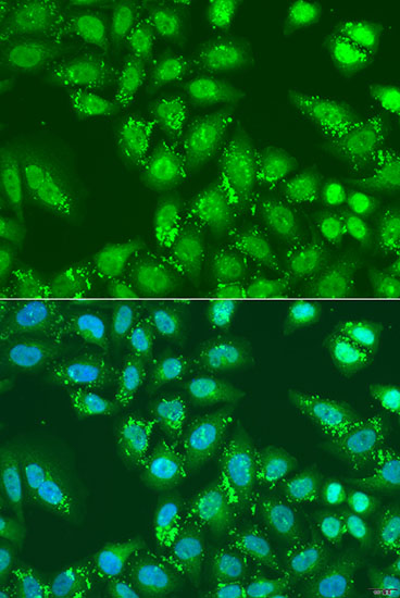 Anti-HDAC4 Antibody (CAB7951)