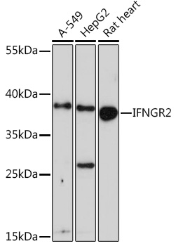 Anti-IFNGR2 Antibody (CAB14221)