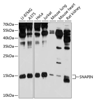 Anti-SNAPIN Antibody (CAB10294)