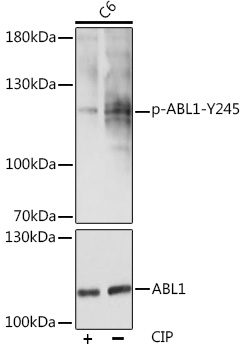 Anti-Phospho-ABL1-Y245 Antibody (CABP0001)