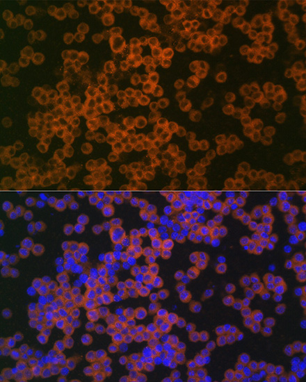 Anti-CD38 Antibody (CAB13611)