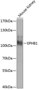 Anti-EPHB1 Polyclonal Antibody (CAB8415)