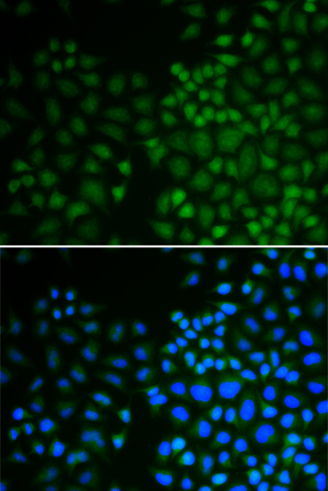 Anti-NR0B2 Antibody (CAB1836)