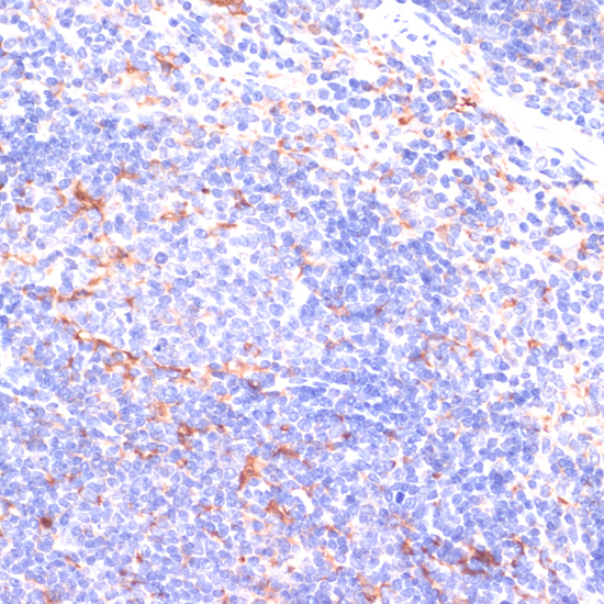 Anti-IKKEpsilon Antibody (CAB0244)