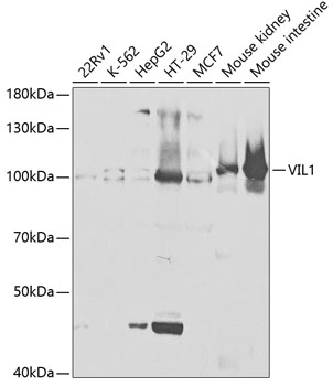 Anti-VIL-1 Antibody (CAB5494)