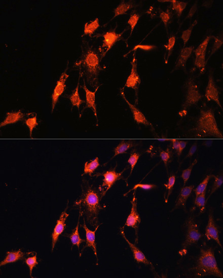 Anti-PRR5 Antibody (CAB15170)